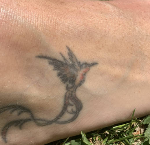 Dry skin on ankle after